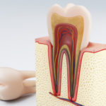 A graphic illustrating the causes and treatments for tooth sensitivity.